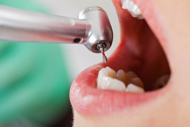 Best Dentist for Dental Trauma  in Big Coppitt Key, FL